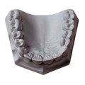 Orthodontic-Stone Orthodontic-Stone